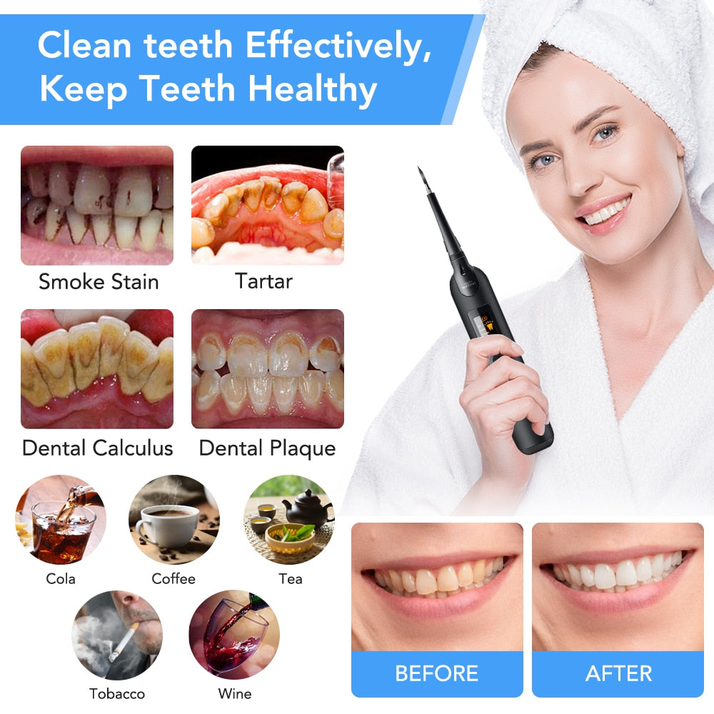 Electric Dental whitener